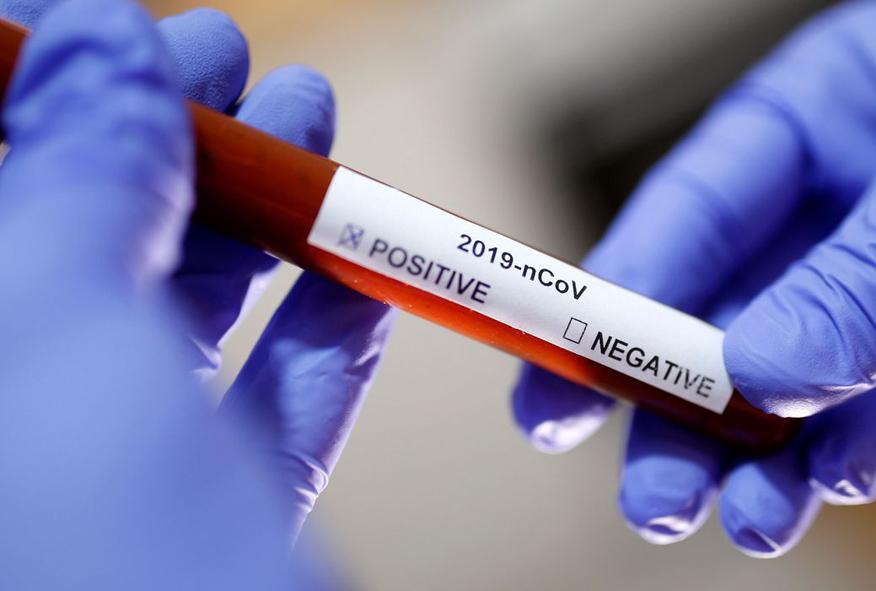 RN passa das 2.240 mortes por Covid-19 e chega a 61,5 mil casos confirmados