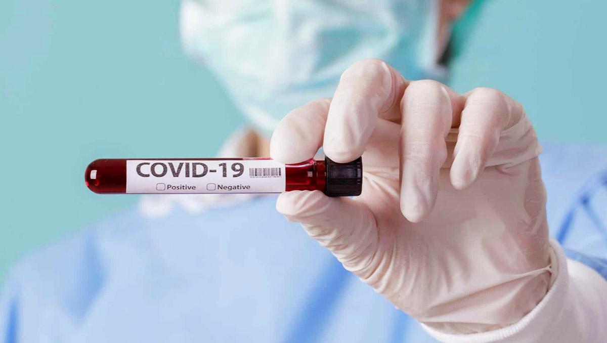 Sesap inicia testagem sorológica em servidores da educação nesta Quinta(08)