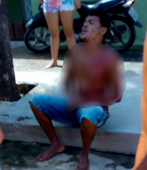 Homem sofre atentado a bala no Bairro Aeroporto II em Mossoró, região Oeste Potiguar