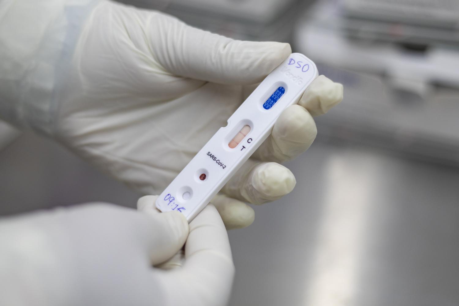 Município de Apodi tem 57 novos casos confirmados de coronavirus em apenas um dia