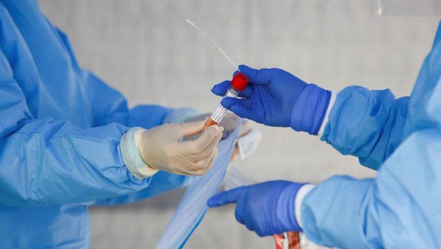 RN ultrapassa 255 mil casos confirmados de infecção pelo novo coronavírus