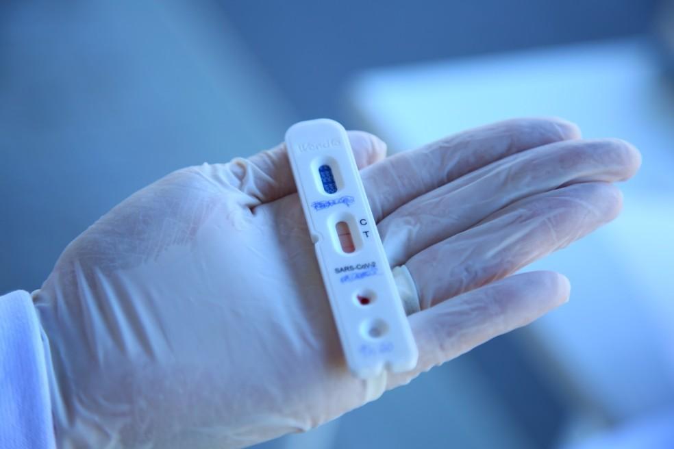 Cidade de Apodi contabiliza mais de 56% da população testada para a Covid-19