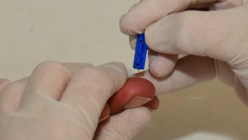 Saúde de Mossoró adquire mais 200 mil teste para detecção da covid-19