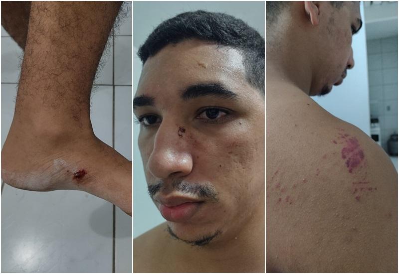 Estudante diz ter sido espancado e ameaçado de morte por grupo que defendia voto impresso em Natal