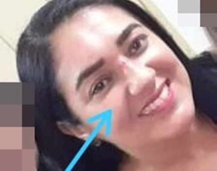 Polícia Militar registra crime de homicídio na cidade de Severiano Melo