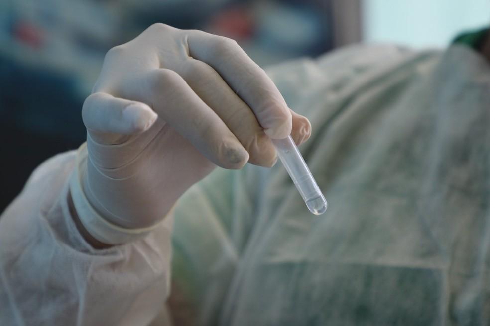 Após seis dias, Rio Grande do Norte volta a registrar mortes por Covid