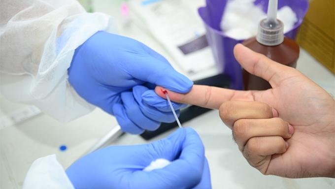 Aumento de casos da variante Delta da Covid-19 no RN acende alerta em municípios