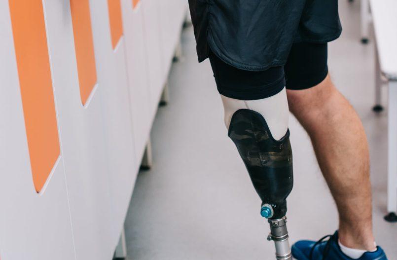 Governo Bolsonaro investe R$ 648 mil para fornecer órteses e próteses à população do RN