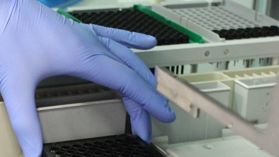 Estudo da UFRN favorece descoberta de novos medicamentos e alvos terapêuticos para Covid