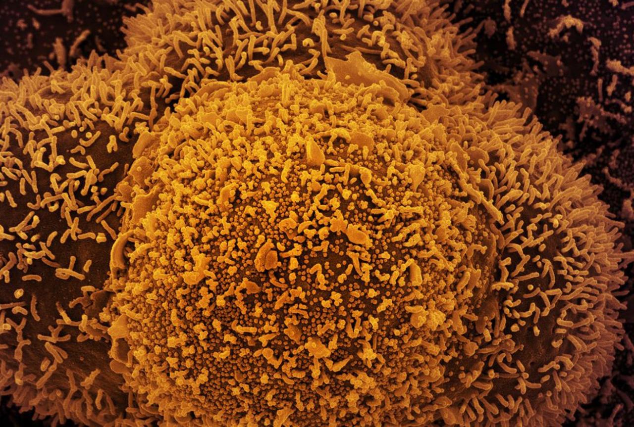 RN deve atingir neste sábado marca de 500 mil casos confirmados de Covid-19