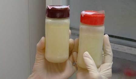 Doação de leite materno cai pela metade em Mossoró; estoque comprometido