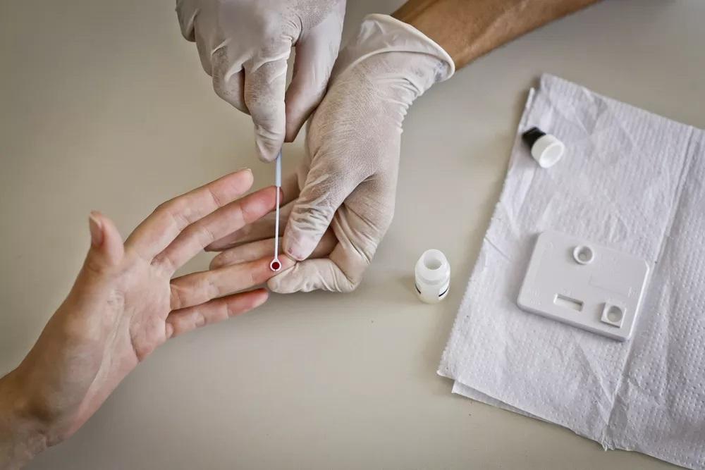 Em uma década, casos de Aids aumentam 36,8% e RN registra 6,4 mil pessoas com a doença