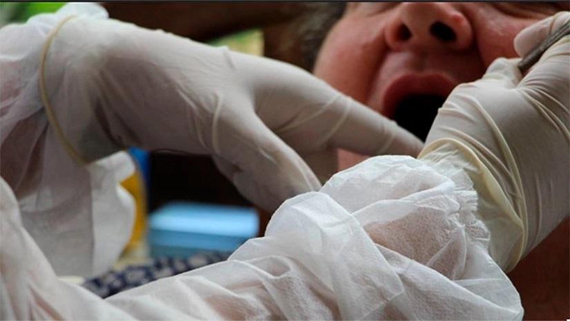 Ministério da Saúde realiza pesquisa de saúde bucal em 12 municípios do Rio Grande do Norte