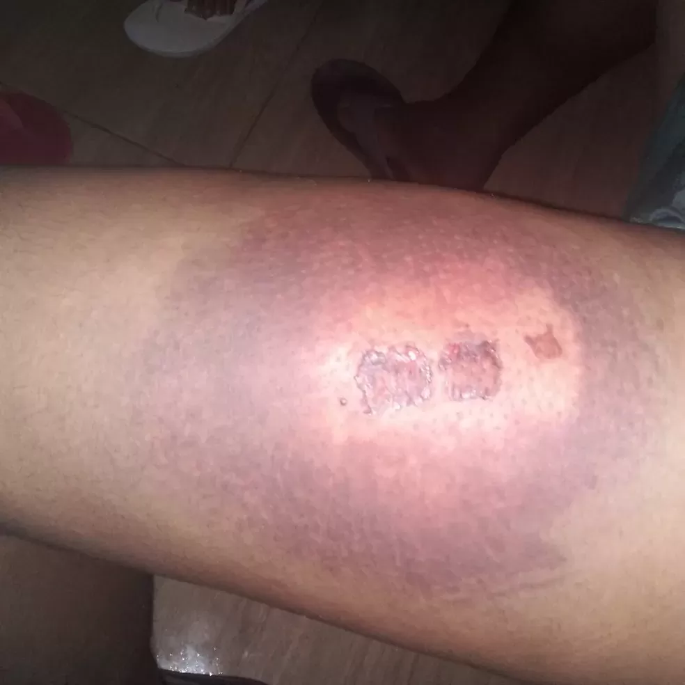 MP diz que vai investigar denúncia de abuso de PMs durante abordagem em Teotônio Vilela, AL