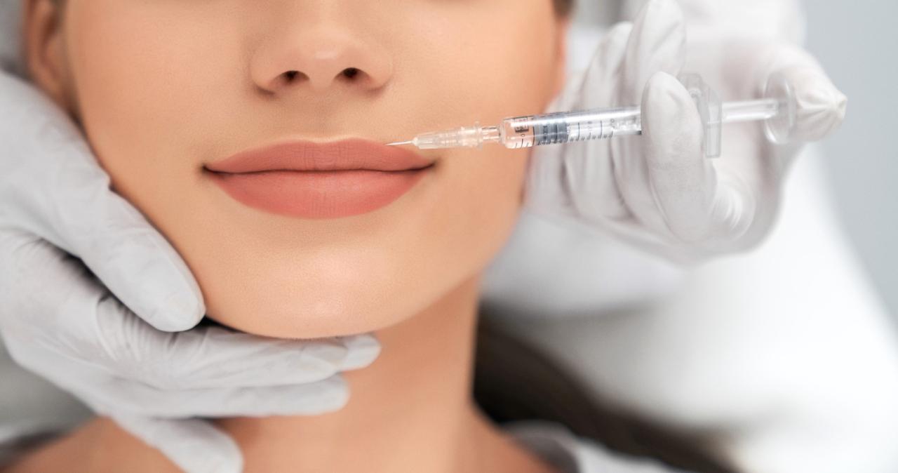 Conheça as melhores dicas antes de fazer um preenchimento labial