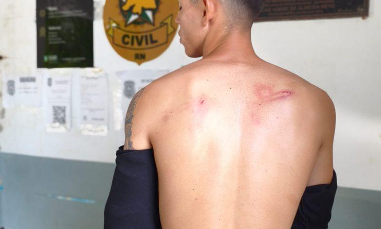 Mais uma vítima denuncia agressão de seguranças durante Carnaval em Apodi