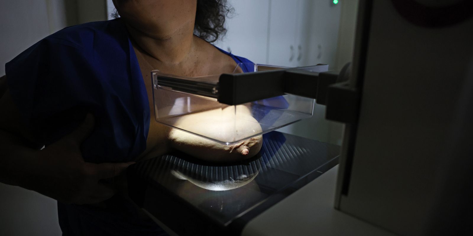Vigitel: 92% das brasileiras entre 50 e 69 anos realizaram mamografia